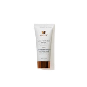 Acne Treatment Lotion