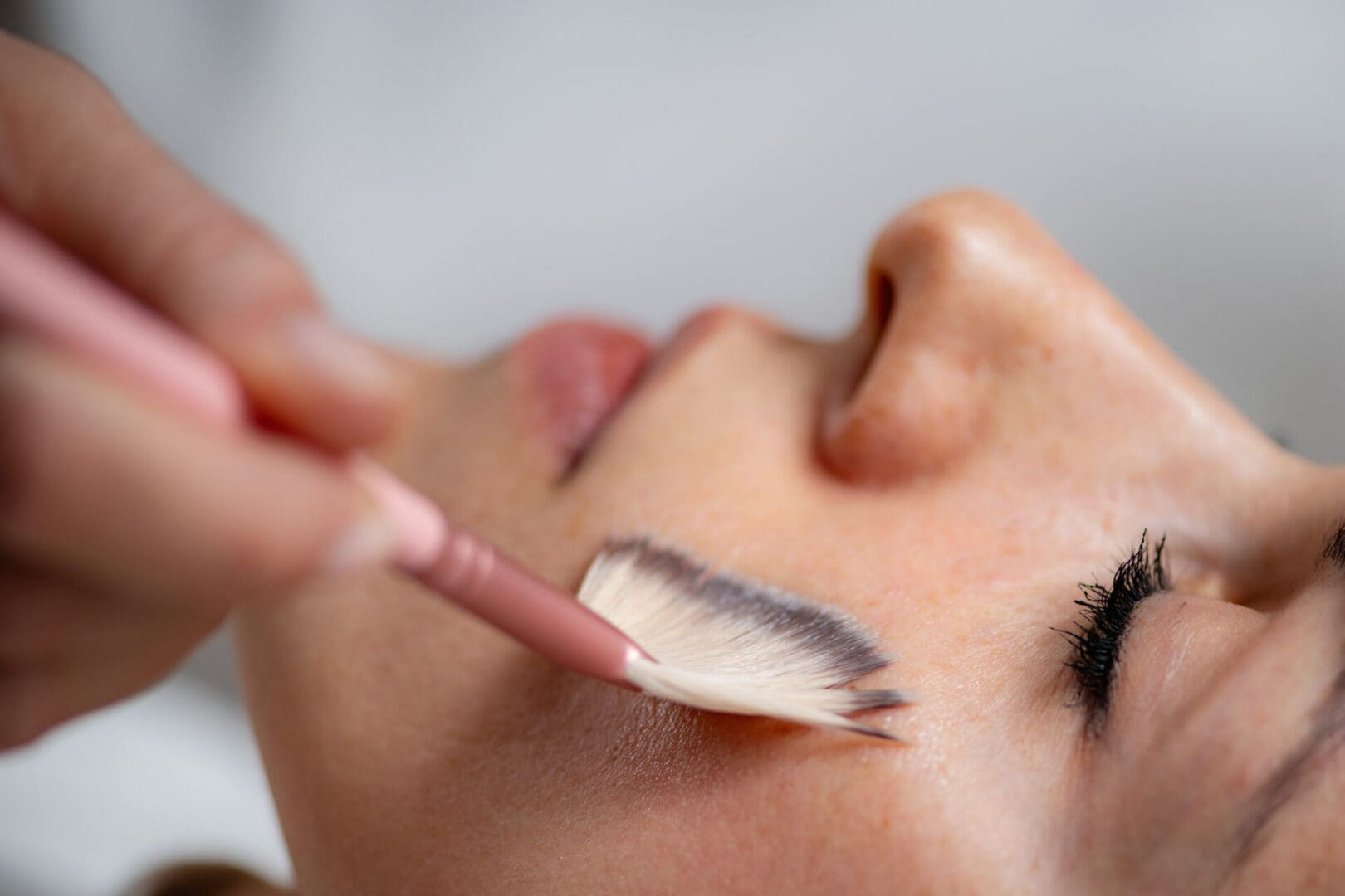 Power of a chemical peel combined with retinol serum for smoother, firmer, and more youthful looking skin
